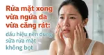 Rửa mặt xong vừa ngứa da vừa căng rát: dấu hiệu nên dùng sữa rửa mặt không bọt