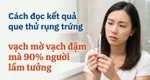 Cách đọc kết quả que thử rụng trứng, vạch mờ vạch đậm mà 90% người lầm tưởng