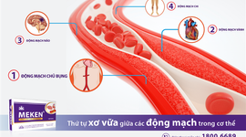MẠCH MÁU NÀO DỄ BỊ XƠ VỮA ĐỘNG MẠCH NHẤT?