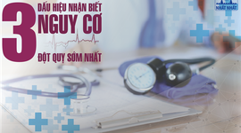 3 Dấu hiệu nhận biết nguy cơ đột quỵ sớm nhất