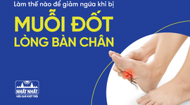 Làm thế nào để giảm ngứa khi bị muỗi đốt lòng bàn chân?