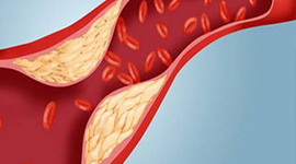ĐAU ĐẦU CHÓNG MẶT, MẤT NGỦ, ĐAU MỎI VAI GÁY, TÊ BÌ CHÂN TAY DO THIỂU NĂNG TUẦN HOÀN