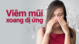 Viêm mũi xoang dị ứng: Dấu hiệu, chẩn đoán và dự phòng
