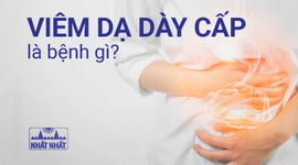 Viêm dạ dày cấp là bệnh gì? Điều trị như thế nào?