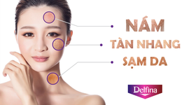 Tuyệt chiêu dưỡng da mặt sau sinh "đẹp mòn con mắt"
