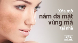 Xóa mờ nám da mặt vùng má tại nhà bằng phương pháp Đông y