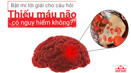 Bật mí lời giải cho câu hỏi “Thiếu máu não có nguy hiểm không?”