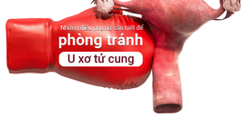 Những điều phụ nữ cần biết để phòng tránh U xơ tử cung