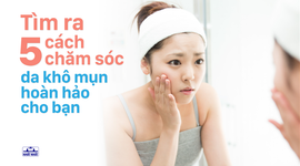 Tìm ra 5 cách chăm sóc da khô mụn hoàn hảo cho bạn