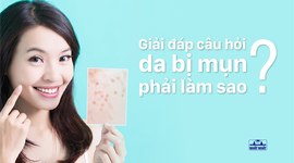 Giải đáp câu hỏi da bị mụn phải làm sao?