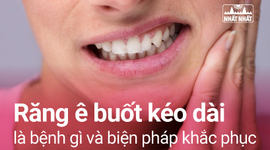 Răng ê buốt kéo dài nguy hiểm hơn nhiều người nghĩ