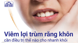 Viêm lợi trùm răng khôn cần điều trị thế nào cho nhanh khỏi?