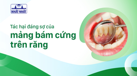 Tác hại đáng sợ của mảng bám cứng trên răng