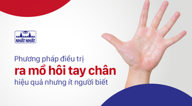 Phương pháp điều trị ra mồ hôi tay chân hiệu quả nhưng ít người biết
