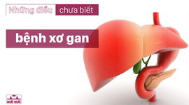 Những điều chưa biết về các giai đoạn của bệnh xơ gan