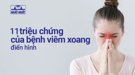 11 triệu chứng viêm xoang chớ nên coi thường!