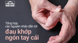 Tổng hợp các nguyên nhân dẫn tới đau khớp ngón tay cái