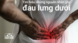 Tìm hiểu những nguyên nhân gây đau lưng dưới