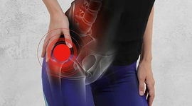Bệnh thoái hóa khớp háng có chữa khỏi hoàn toàn không?