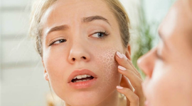 Cách cải thiện độ ẩm của da vào mùa hanh khô
