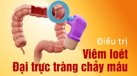 Viêm loét đại trực tràng chảy máu có nguy hiểm không? 