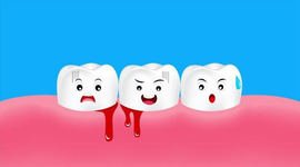Đánh răng chảy máu chân răng: Nguyên nhân và cách khắc phục