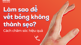 Làm sao để vết bỏng không thành sẹo? Cách chăm sóc hiệu quả