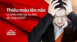 Thiếu máu lên não có biểu hiện gì cụ thể, dễ nhận biết?