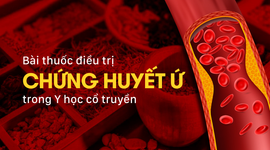 Bài thuốc điều trị chứng huyết ứ trong Y học cổ truyền
