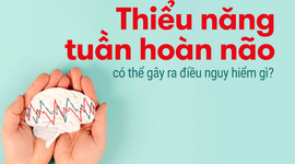Thiểu năng tuần hoàn não có thể gây ra điều nguy hiểm gì?