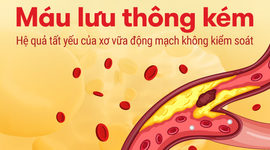 Máu lưu thông kém - Hệ quả tất yếu của xơ vữa động mạch không kiểm soát