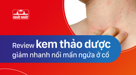 Review kem thảo dược giảm nhanh nổi mẩn ngứa ở cổ