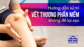 Hướng dẫn xử trí vết thương phần mềm không để lại sẹo