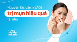 Nguyên tắc cần nhớ để trị mụn hiệu quả tại nhà