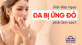 Giải đáp ngay: Da bị ửng đỏ phải làm sao?