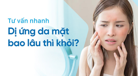 Tư vấn nhanh: Dị ứng da mặt bao lâu thì khỏi?