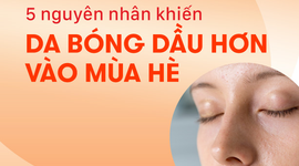5 nguyên nhân khiến da bóng dầu hơn vào mùa hè