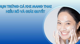 Mụn trứng cá khi mang thai: Hiểu rõ và giải quyết