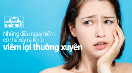 Viêm lợi thường xuyên chớ nên chủ quan vì có thể dẫn đến nhiều biến chứng