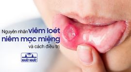 Viêm loét niêm mạc miệng sẽ không còn đáng sợ nếu biết cách!