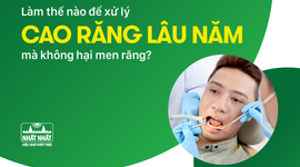 Làm thế nào để xử lý cao răng lâu năm mà không hại men răng?