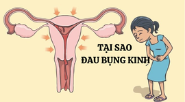 Tại sao đau bụng kinh? Nguyên nhân và cách cải thiện