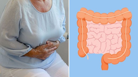 Táo bón ở người già – Không nên chủ quan!