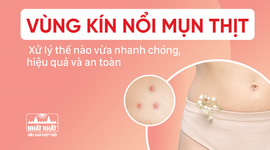 Vùng kín nổi mụn thịt: Hướng dẫn cách xử trí nhanh 