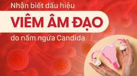 Dấu hiệu nhận biết viêm âm đạo do nấm ngứa Candida