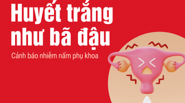 Huyết trắng vón cục như bã đậu: Cảnh báo nhiễm nấm phụ khoa
