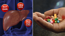 TỰ HỦY HOẠI GAN DO SỬ DỤNG KHÁNG SINH BỪA BÃI
