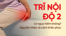 Trĩ nội độ 2 có nguy hiểm không? Nguyên nhân và cách khắc phục