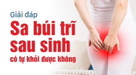 Giải đáp: Sa búi trĩ sau sinh có tự khỏi được không?