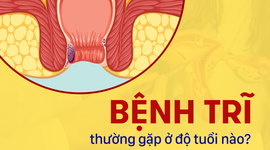 Giải đáp: Bệnh trĩ thường gặp ở độ tuổi nào?